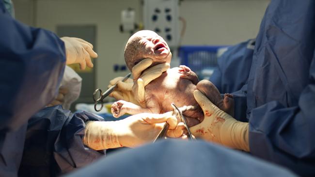The birth of a baby is a precious moment, but that doesn’t mean it belongs on social media. Picture: iStock