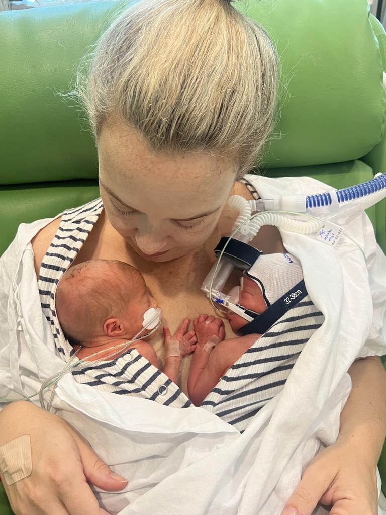 Jorgia Huxtable with twins Tilly and Mabel. The twins were forced to fight for their lives after contracting enterovirus myocarditis and enterovirus meningitis. Picture: Supplied.