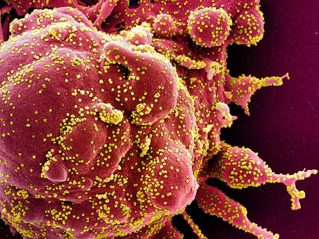 This handout image obtained on April 29, 2020 and released by the National Institute of Allergy and Infectious Diseases (NIAID) of the National Institutes of Health (NIH), shows a colorized scanning electron micrograph of an apoptotic cell (red) heavily infected with SARS-COV-2 virus particles (yellow), isolated from a patient sample captured at the NIAID Integrated Research Facility (IRF) in Fort Detrick, Maryland. - The US intelligence community said Thursday it had concluded that the novel coronavirus that has swept the globe originated in China but was not man-made or engineered. (Photo by Handout / National Institute of Allergy and Infectious Diseases / AFP) / RESTRICTED TO EDITORIAL USE - MANDATORY CREDIT "AFP PHOTO / NATIONAL INSTITUTE OF ALLERGY AND INFECTIOUS DISEASES, NIH " - NO MARKETING - NO ADVERTISING CAMPAIGNS - DISTRIBUTED AS A SERVICE TO CLIENTS