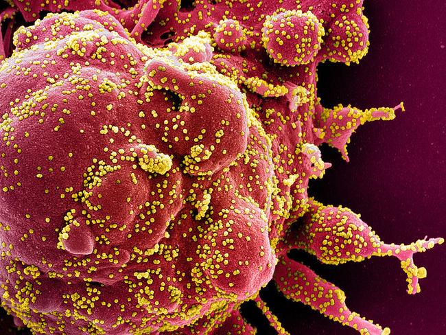 This handout image obtained on April 29, 2020 and released by the National Institute of Allergy and Infectious Diseases (NIAID) of the National Institutes of Health (NIH), shows a colorized scanning electron micrograph of an apoptotic cell (red) heavily infected with SARS-COV-2 virus particles (yellow), isolated from a patient sample captured at the NIAID Integrated Research Facility (IRF) in Fort Detrick, Maryland. - The US intelligence community said Thursday it had concluded that the novel coronavirus that has swept the globe originated in China but was not man-made or engineered. (Photo by Handout / National Institute of Allergy and Infectious Diseases / AFP) / RESTRICTED TO EDITORIAL USE - MANDATORY CREDIT 