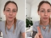 Mum issues warning about treating burns on kids