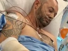 Gavin Zeunert underwent nine hours of surgery and shattered both of his legs after an unlicensed driver allegedly struck him in a hit and run crash. Picture: Supplied