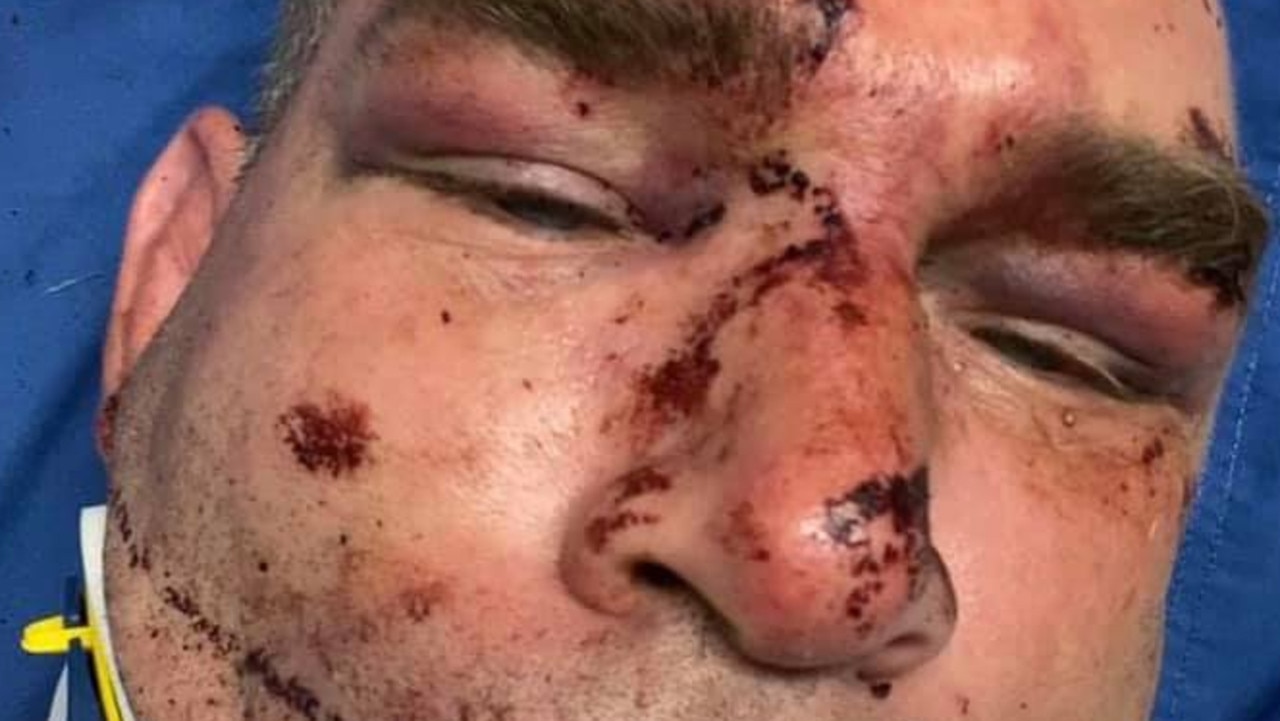 Dad of three Ben Woolley, 44, was bashed by a gang of thugs on at Ron Andrews Park in Pakenham on January 2. Picture: Facebook