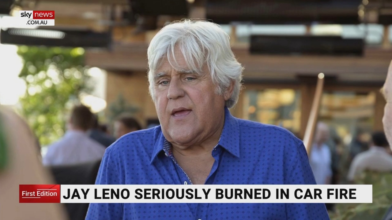 Jay Leno seriously burnt after car fire | Sky News Australia