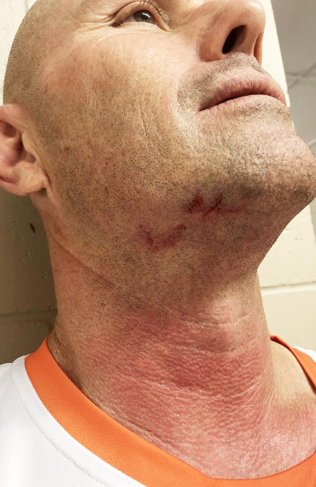 Rugby league referee Brian Roper was kicked in the throat while umpiring a game at Acacia Ridge between Dayboro and Souths Inala Warriors, he was hospitalised for two nights. Picture: Contributed