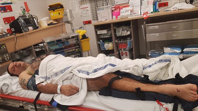 John Ponte, 55, was left with several broken bones in a cowardly hit-and-run on the Gold Coast on Wednesday. Picture: Leeanne Ponte.