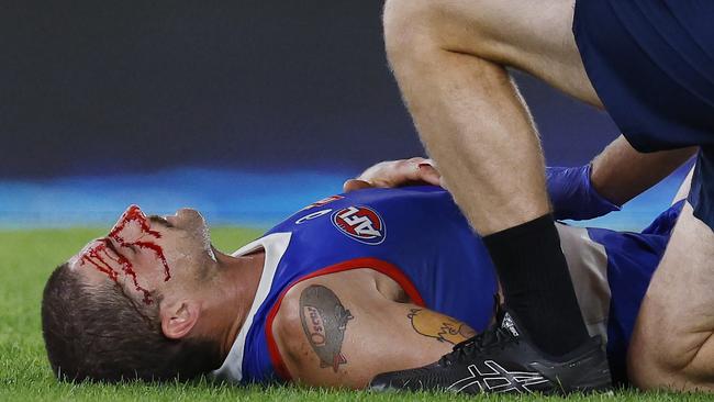 Tom Liberatore was attended to by trainers after copping an accidental boot to the head late in the final term against Hawthorn on Sunday. Picture: Michael Klein