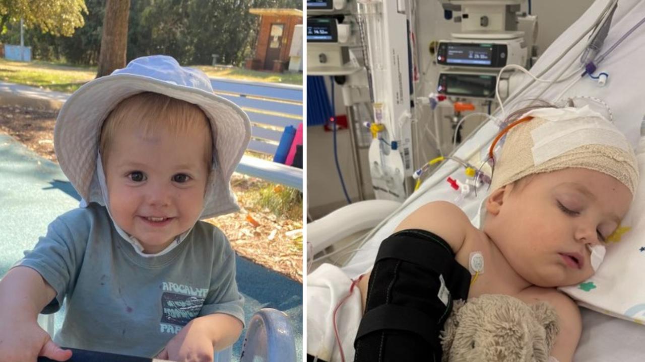 Brave toddler unable to walk, talk amid brain cancer battle