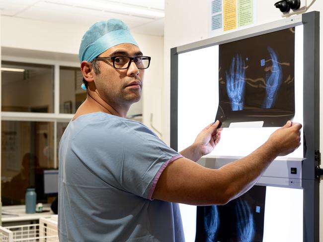 Dr Blaise Wardle examines X-rays from an angle grinder injury. Picture: Monique Harmer