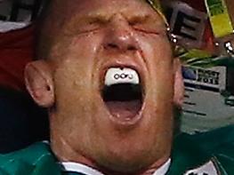 CARDIFF, WALES - OCTOBER 11: Paul O'Connell of Ireland reacts as he receives medical treatment during the 2015 Rugby World Cup Pool D match between France and Ireland at Millennium Stadium on October 11, 2015 in Cardiff, United Kingdom. (Photo by Stu Forster/Getty Images)