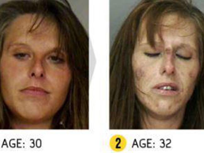 Drug Addiction Before And After Photos Show Shocking Reality Of Addicts News Com Au