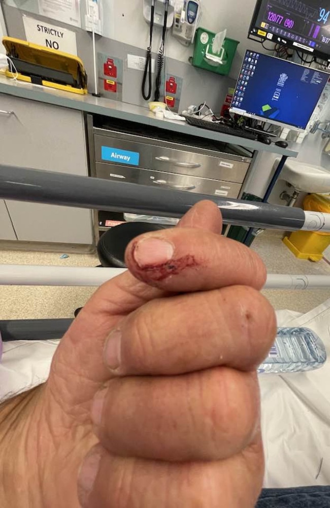 Mr Glaser was bitten on the finger by an eastern brown last month. Picture: Facebook