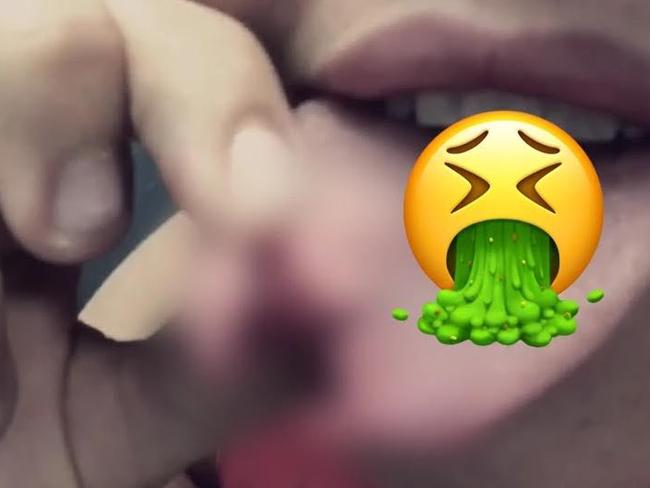 Ebony Marinoff sent around a picture of her split tongue on Snapchat. The graphic image has been blurred.