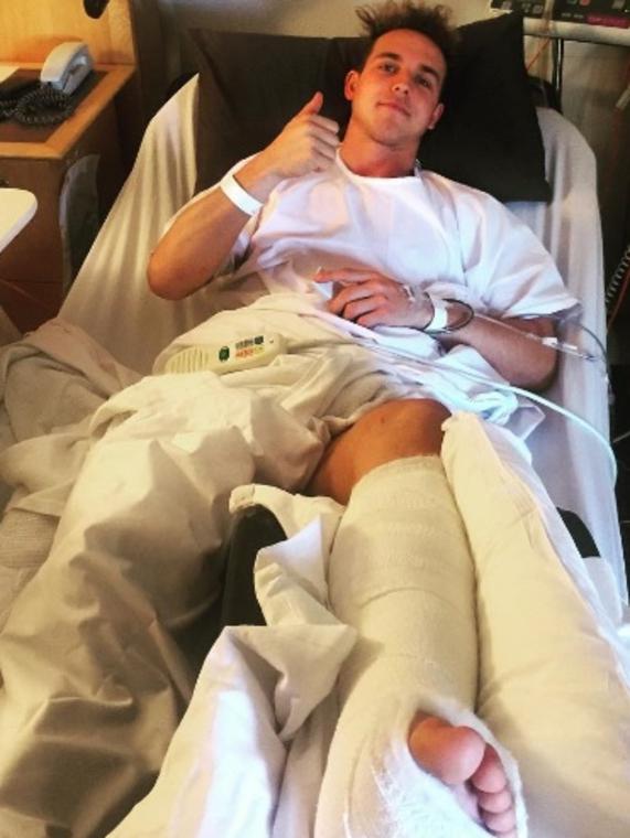 Mitch Wallis in hospital after breaking his leg.