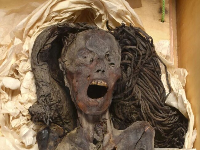 Picture of the Egyptian mummy who was buried in 'immense pain'. Credit: Credit: Sahar Saleem