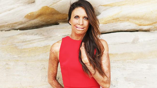 Turia Pitt’s teen guide to a kick-ass life