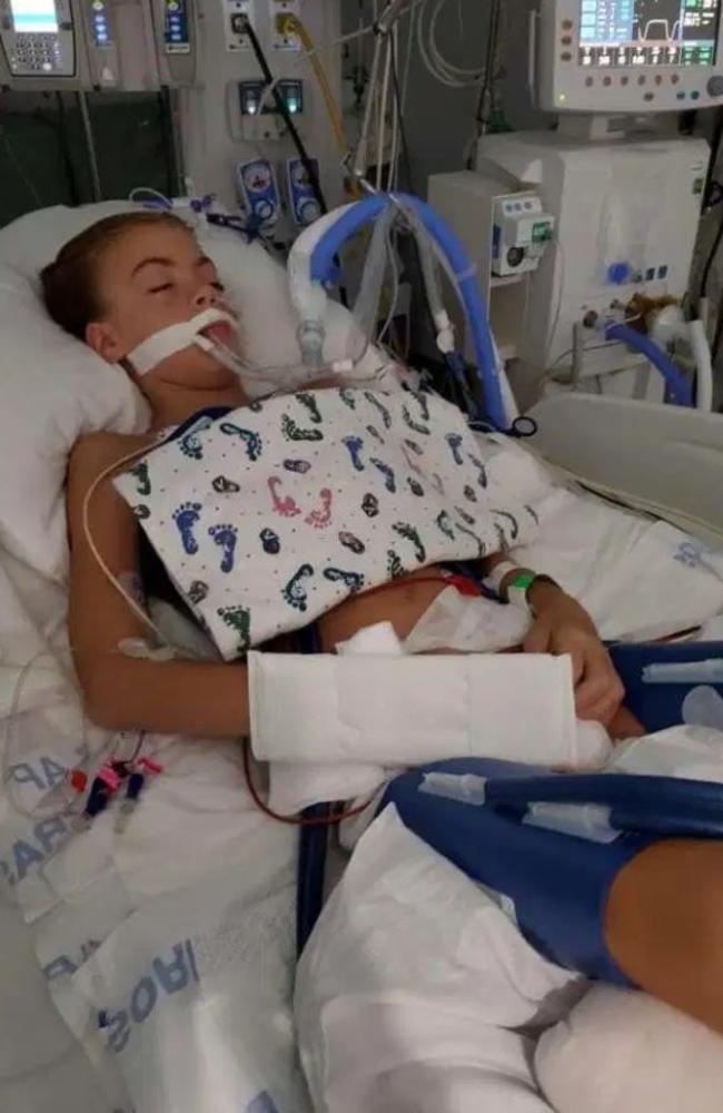 Girl In Coma After Contracting Brain-eating Parasite While Swimming In ...