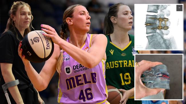 Opals and WNBL star Sara Blicavs has undergone serious spinal surgery.