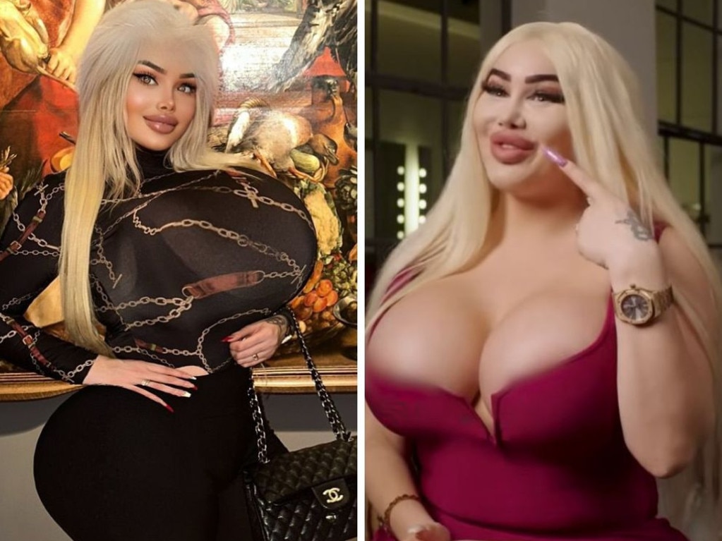 Woman spends $333K on plastic surgery