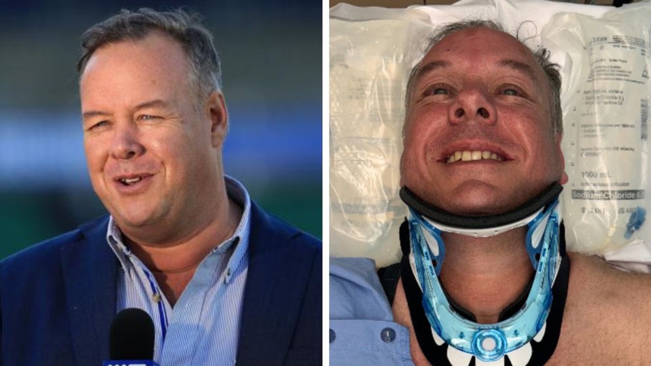 NRL presenter Ben Dobbin suffers horror injuries in bike crash