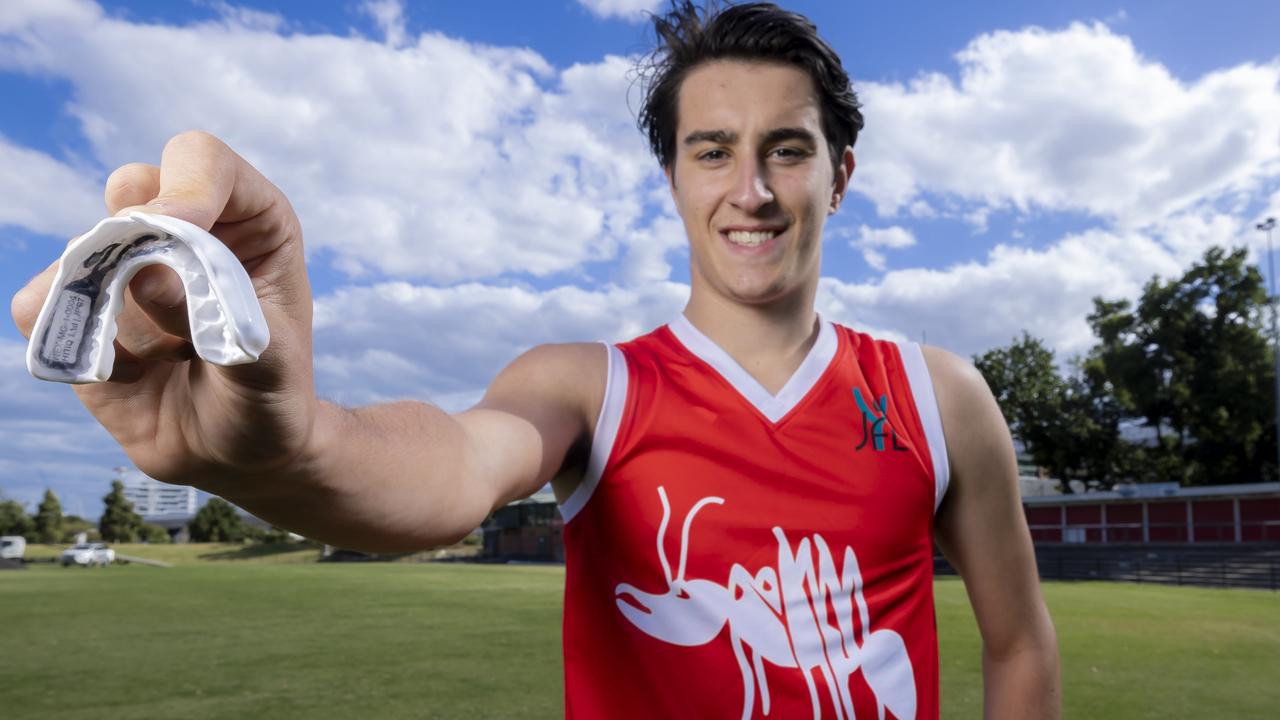 Nick Perizzolo from Northern Bullants with a smart mouthguard. Picture: Wayne Taylor