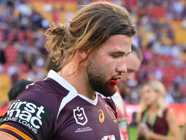 NRL 2025 RD11 Brisbane Broncos v St. George Illawarra Dragons - Patrick Carrigan, Dejection