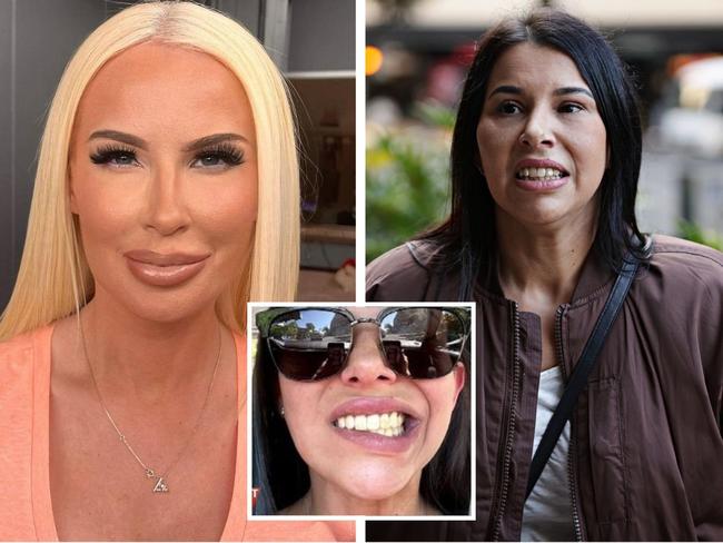 Disfigured’ customer confronts Botox boss at court