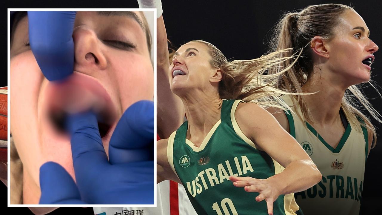 Graphic warning: Opal’s optimism despite injury, selection trauma