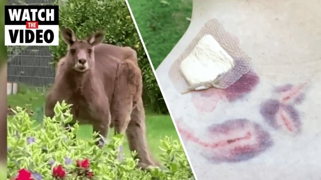 55-year-old woman brutally attacked by kangaroo in her own backyard (9 News)