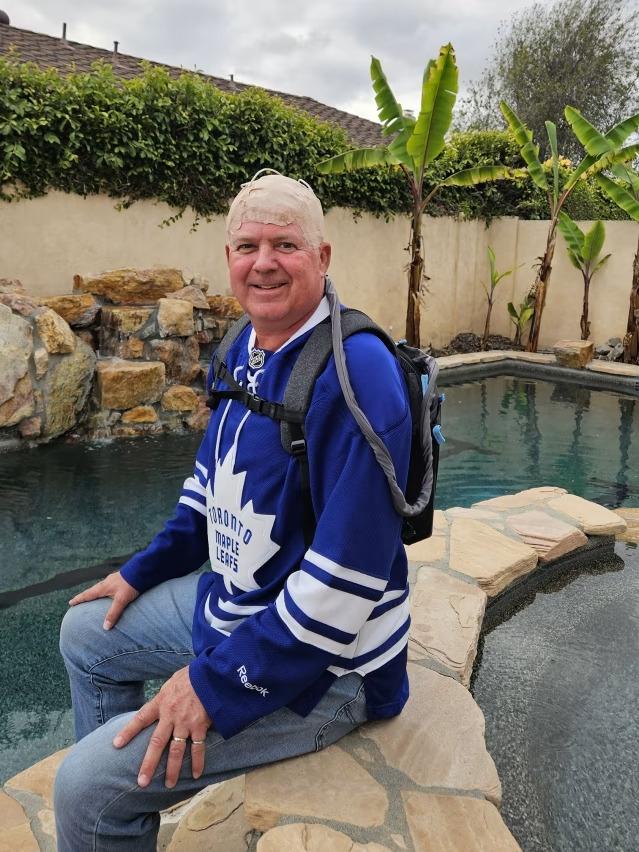 Tim Nugent wears Novocure’s device to treat his glioblastoma at least 18 hours a day. Picture: Maya Nugent / WSJ