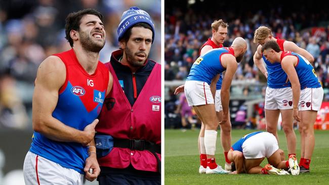 Petracca, clutching his side in agony, was escorted to the rooms at the break, with lingering doubts about his ability to continue. He was eventually taken to hospital in an ambulance.