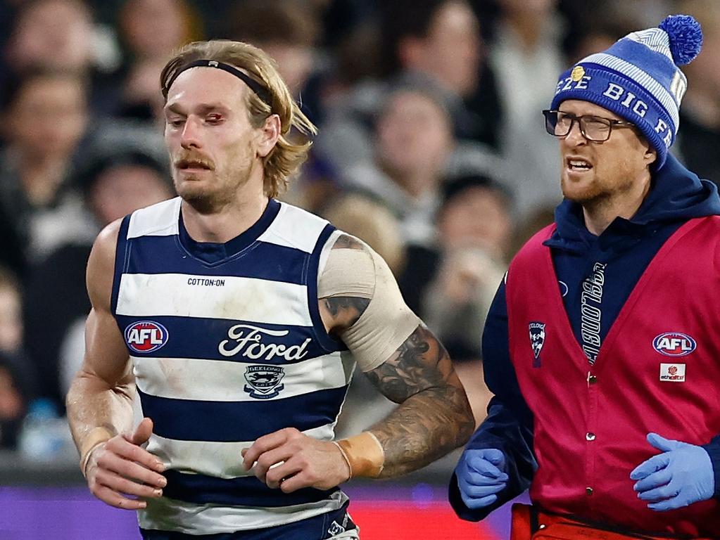 MELBOURNE, AUSTRALIA – JULY 12: Tom Stewart of the Cats is seen injured during the 2024 AFL Round 18 match between the Collingwood Magpies and the Geelong Cats at Melbourne Cricket Ground on July 12, 2024 in Melbourne, Australia. (Photo by Michael Willson/AFL Photos via Getty Images)