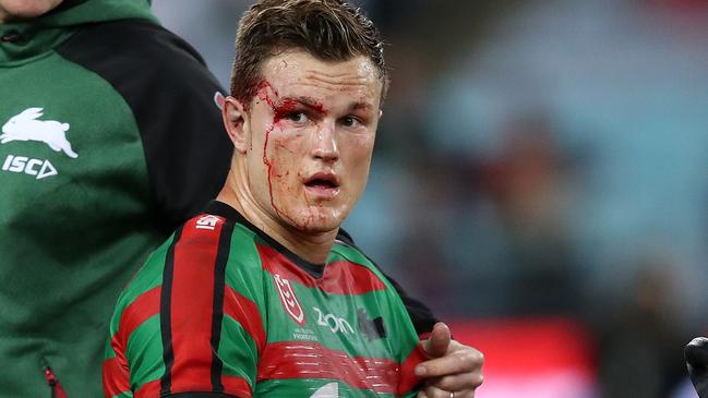 Liam Knight leaves the field during the Rabbitohs’ clash with the Roosters. Picture: Phil Hillyard