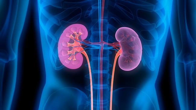 Researchers around the world have searched in vain for a genetic biomarker of kidney disease in people with diabetes. Picture: iStock