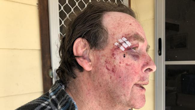 Graham Triffitt, Culburra butcher, victim of alleged attack.