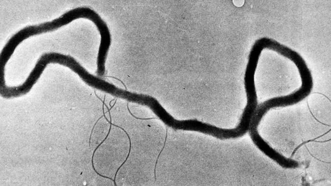 FILE - In this May 23, 1944 file photo, the organism treponema pallidum, which causes syphilis, is seen through an electron microscope. Las Vegas is experiencing a syphilis outbreak, as health officials warn of a national spike in cases that some are tying to increased testing, as well as the prevalence of anonymous sex through social media and a less consistent use of condoms. (AP Photo, File)