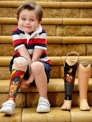William with his Superman-themed prosthetic leg in 2016. Picture: Bianca De Marchi