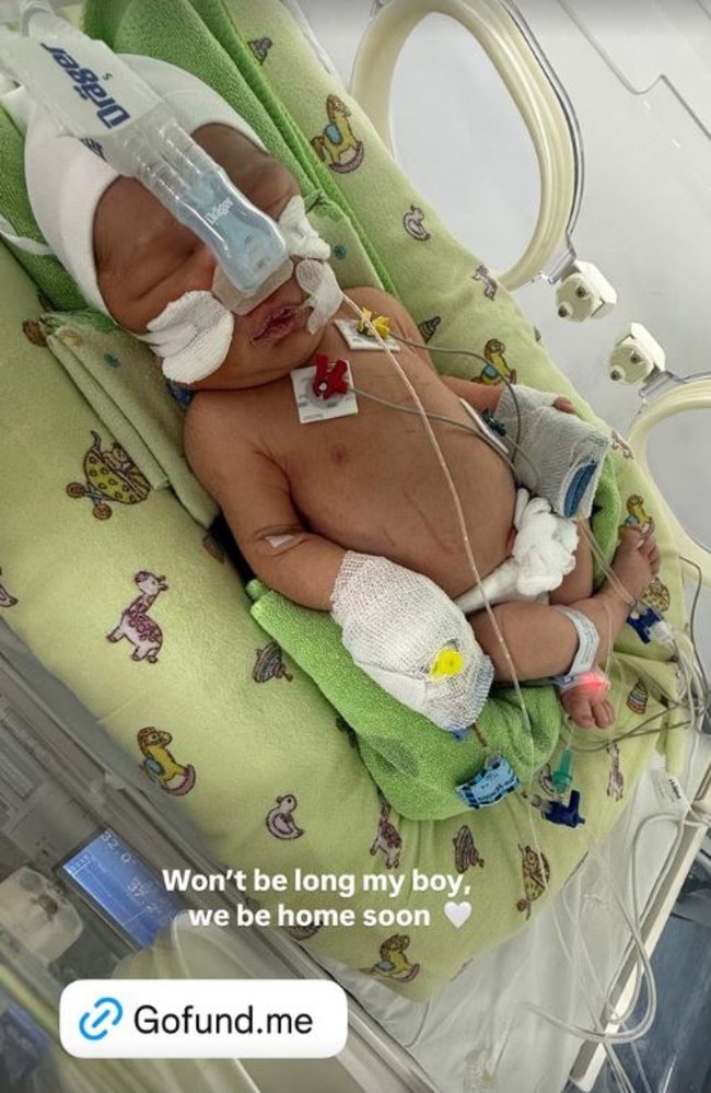 Support from the community for baby Teo has been strong. Picture: Instagram