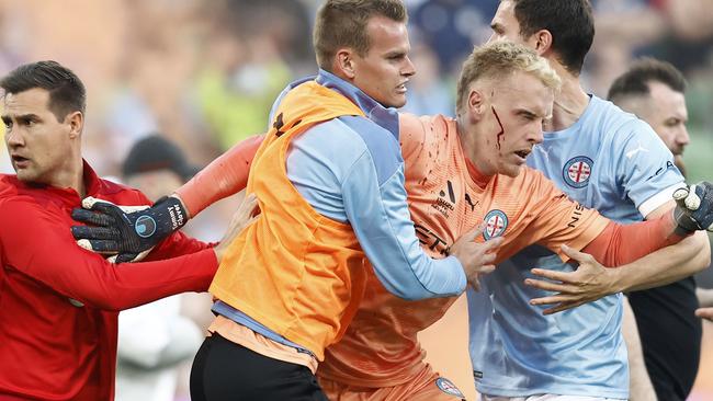 A bleeding Tom Glover is escorted from the pitch by teammates and security after fans stormed the pitch. Picture: Darrian Traynor/Getty Images