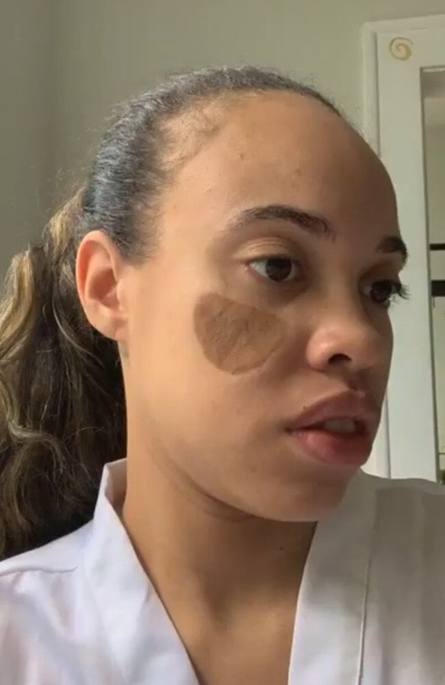 The mum says she is worried about her daughter getting teased. Picture: Botched/E!