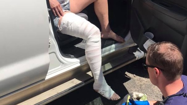 A woman is lucky to be alive after she was bitten by a brown snake in Woronora in Sydney's south in November 2018. Picture: Graham Huckel