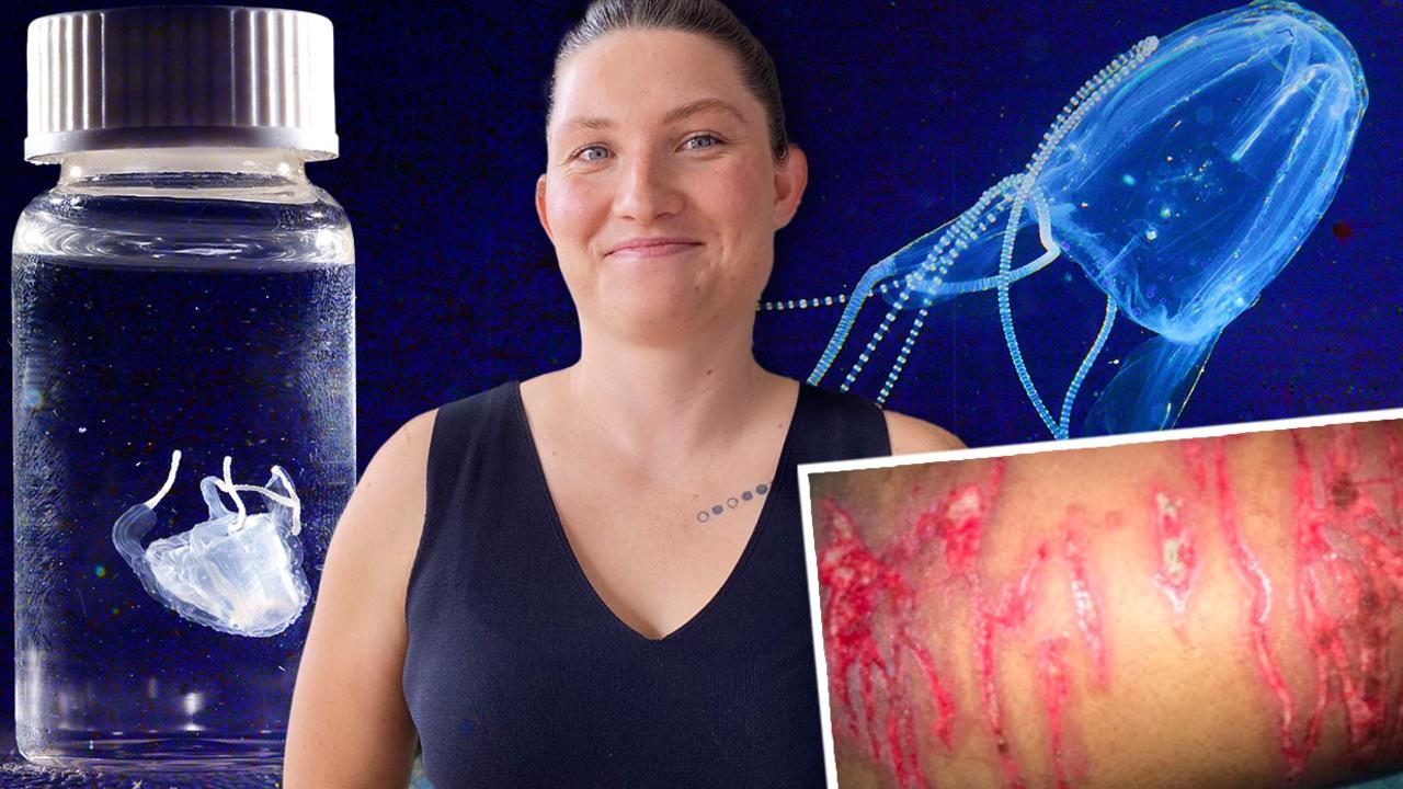 box jellyfish attack