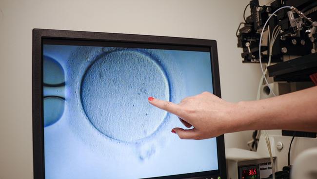 It’s hoped the new technology will allow couples opt for artificial insemination, avoiding invasive procedures like intracytoplasmic sperm injection, which involves injecting a single sperm into an egg before placing it into a woman’s uterus. (Photo by Ivan Couronne / AFP)