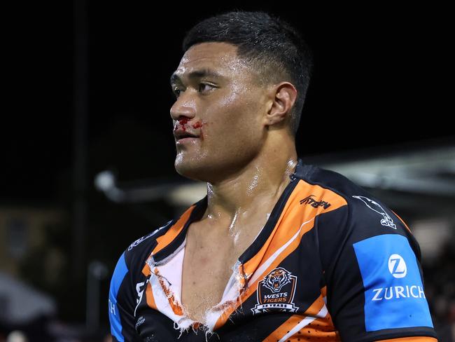 SYDNEY, AUSTRALIA - JULY 06: Stefano Utoikamanu of the Wests Tigers leaves the fiels with a bloody nose and ripped shirt during the round 18 NRL match between Wests Tigers and Melbourne Storm at Leichhardt Oval, on July 06, 2024, in Sydney, Australia. (Photo by Scott Gardiner/Getty Images)