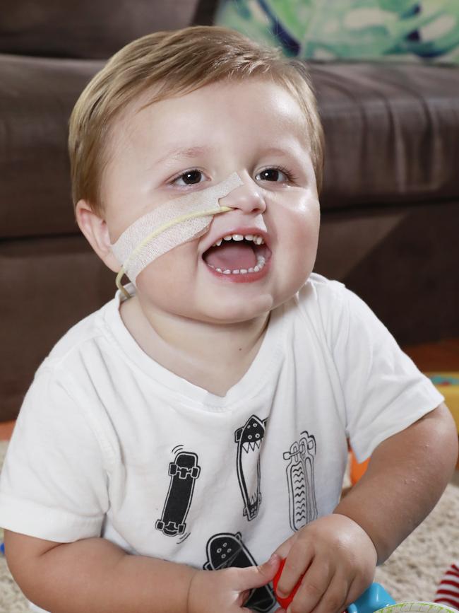 Isaac Schulz was diagnosed with a brain tumour at just four months old. He’ll turn three in May. Picture: Claudia Baxter/AAP