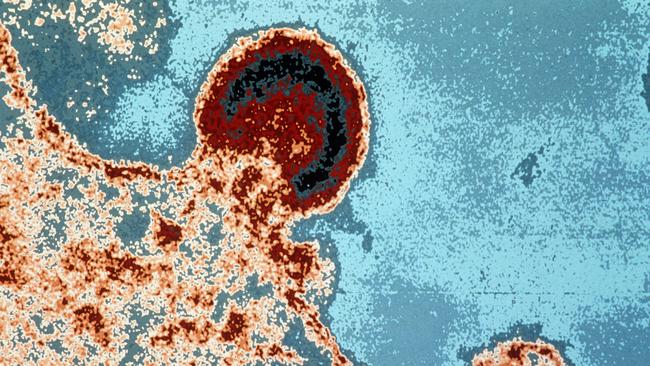 The HIV 1 virus on a lymphocyte cell.