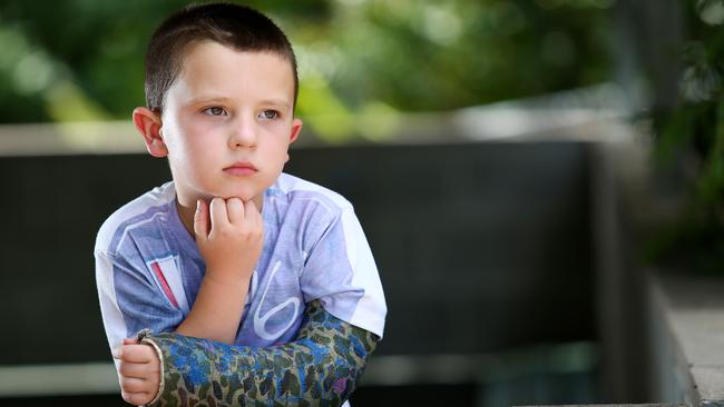 Christopher French, 5, of Cedarvale, fell off a retaining wall. Picture: Peter Cronin