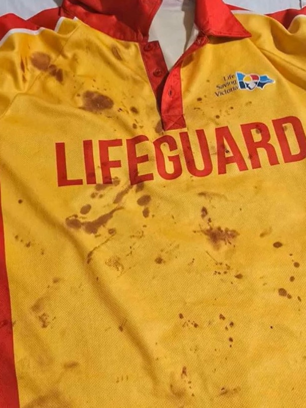 The lifeguard’s uniform was splattered with blood. Picture: Nine News