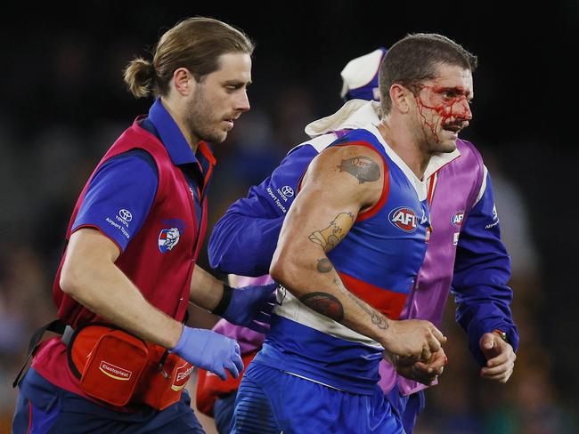 MELBOURNE , AUSTRALIA. May 4, 2024.  AFL Round 8. . Western Bulldogs vs Hawthorn at Marvel Stadium.   Bulldog Tom Liberatore heads to the bench after copping an accidental boot in the heads in the dying minutes   . Pic: Michael Klein