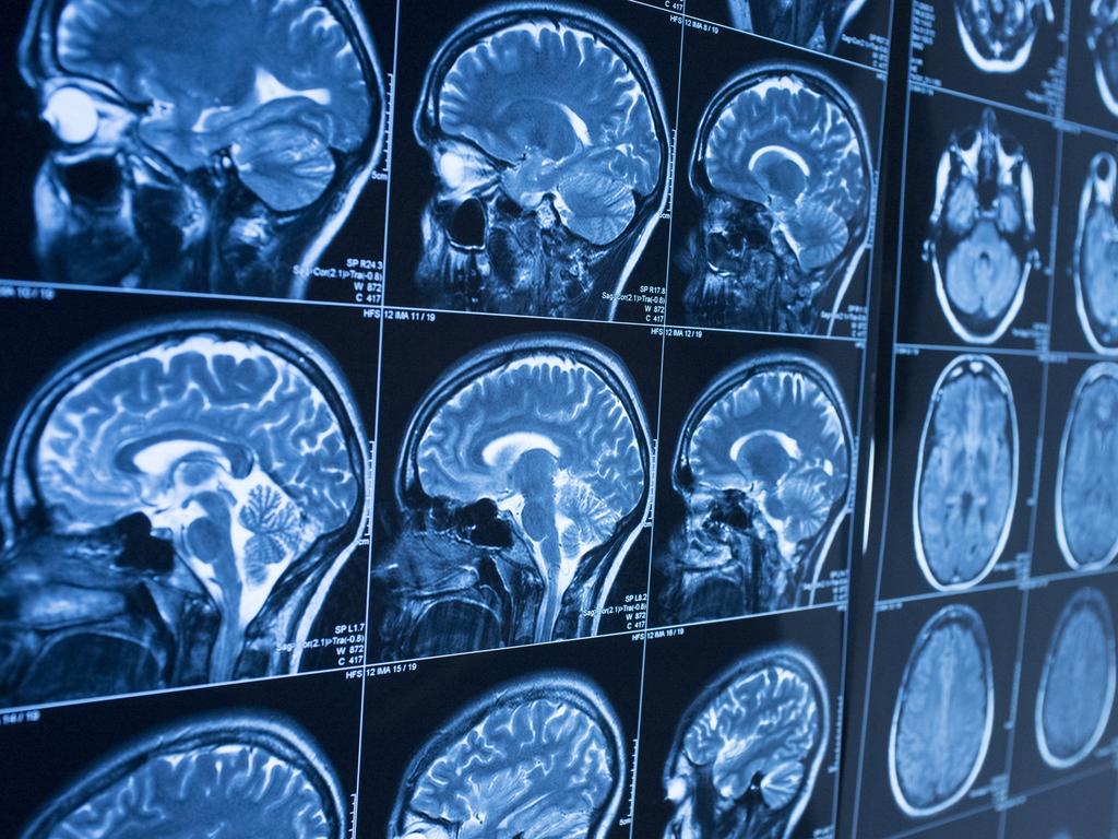 DEAL 16 AUG 2019
Brain science Pic : iStock